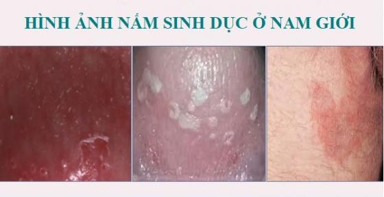 1763015097945834.jpg nam-sinh-dcu.jpg