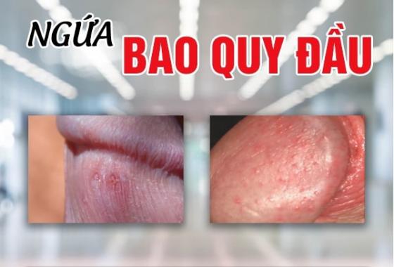 1763019011142920.jpg ngua-bao-quy-dau.jpg