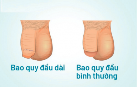 1763019852351558.png Thiết kế chưa có tên (83).png