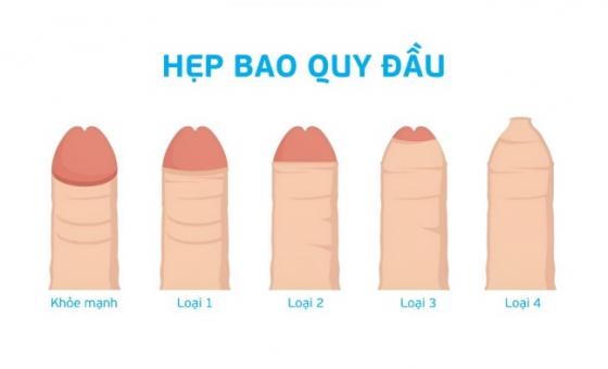 1763020441809409.jpg hep-bad.jpg