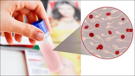 1763025187373126.jpg XUAT-TINH-RA-MAU.jpg