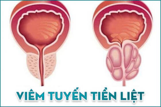 1763088415112209.png Thiết kế chưa có tên (81).png