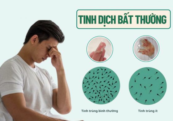 tinh-dich-bat-thuong.png